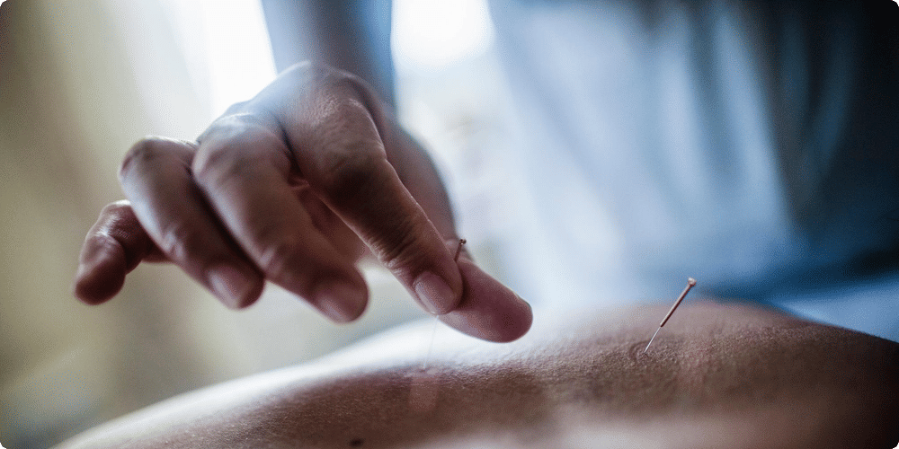Quand choisir la pressothérapie ou l'acupuncture ?
